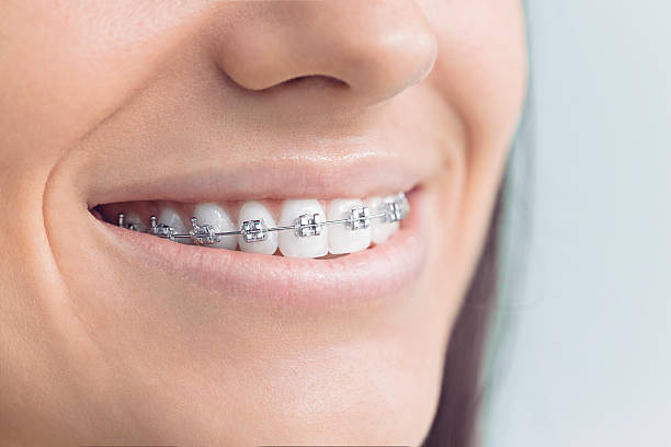 Why Choose Us for Your Dental Needs in Barrington Hills, IL